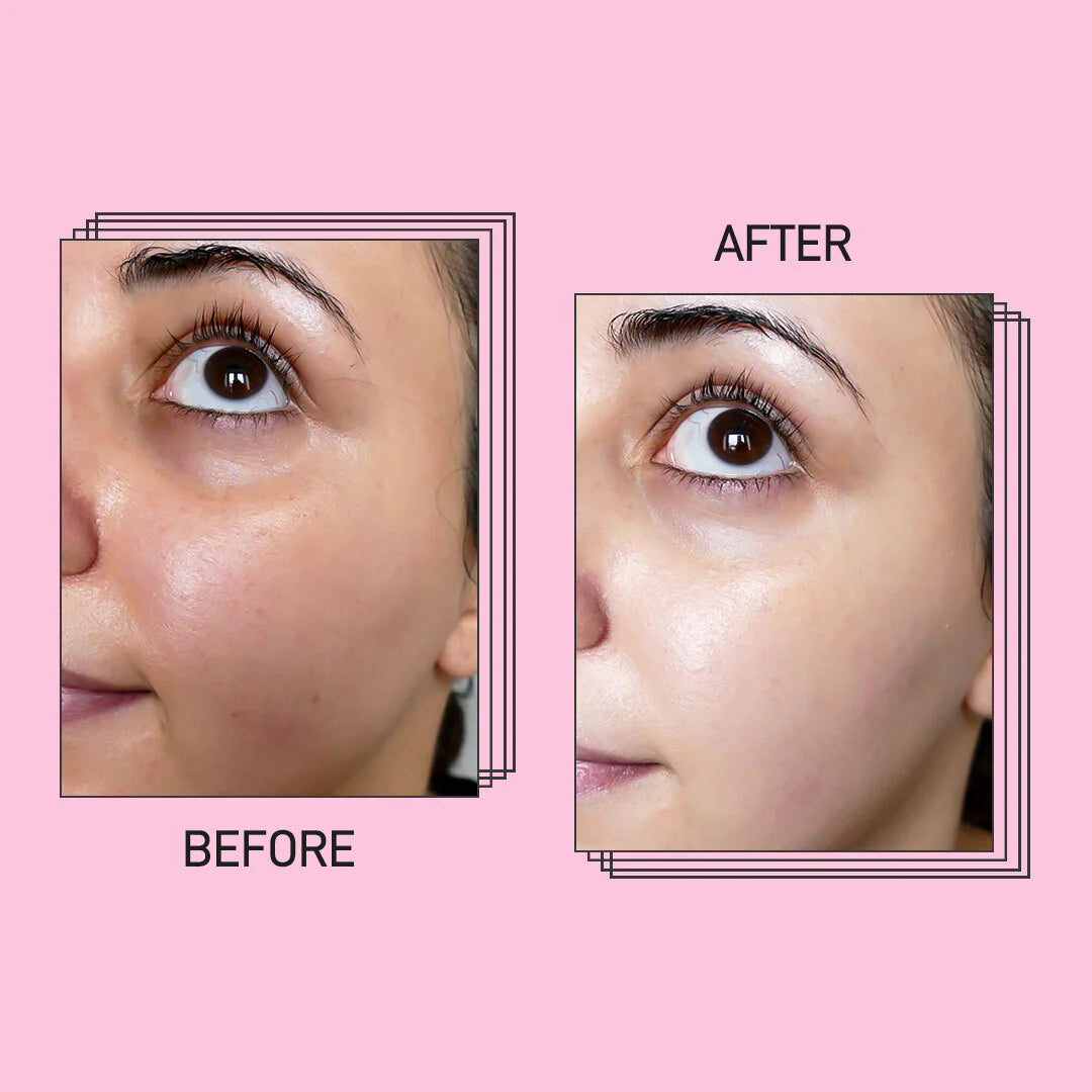 MASCA CU OREZ - Iluminare & Uniformitate